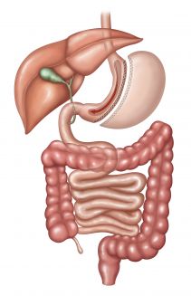 Gastric Sleeve (Gastrectomy)